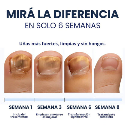 2x1  NailClear Pro™ – Parches Intensivos Antihongos para Uñas (32 Parches)